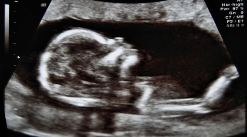 Pericolo di vita con i test prenatali